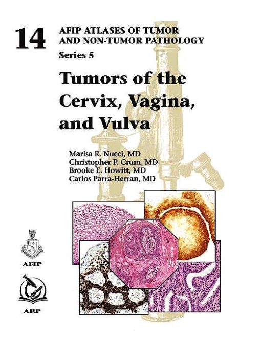 Tumors of the Cervix, Vagina, and Vulva (AFIP Atlas of Tumor Pathology, Series 5)