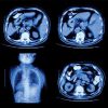 UCSF Abdominal and Thoracic Imaging 2022