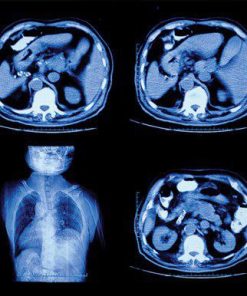 UCSF Abdominal and Thoracic Imaging 2022