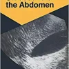 Ultrasound of the Abdomen: 114 Radiological Exercises for Students and Practitioners (Exercises in Radiological Diagnosis)