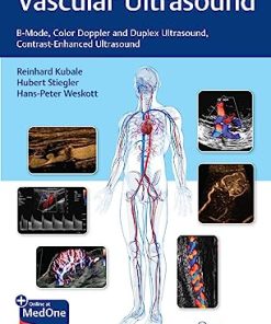 Vascular Ultrasound: B-Mode, Color Doppler and Duplex Ultrasound, Contrast-Enhanced Ultrasound (Original PDF from Publisher+Videos)