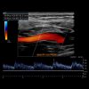 479 society for vascular medicine comprehensive review of vascular ultrasound interpretation and registry preparation cme 98672
