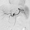 518 nyu langone vascular and interventional radiology review and update cme 88713