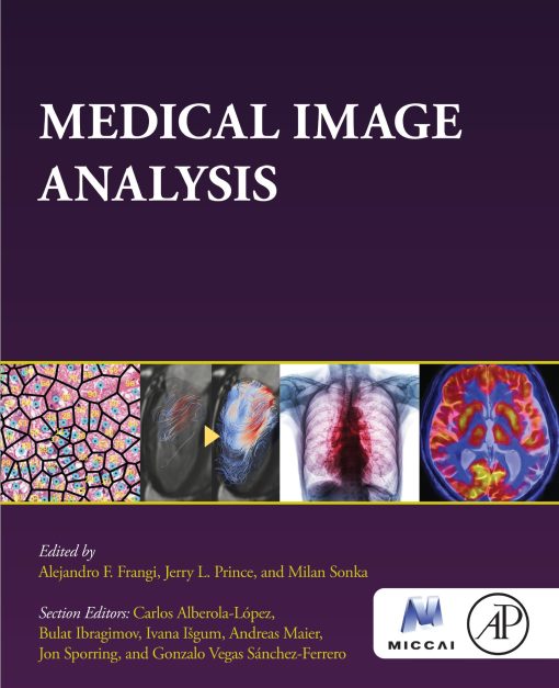 Medical Image Analysis (The MICCAI Society book Series) (EPUB)