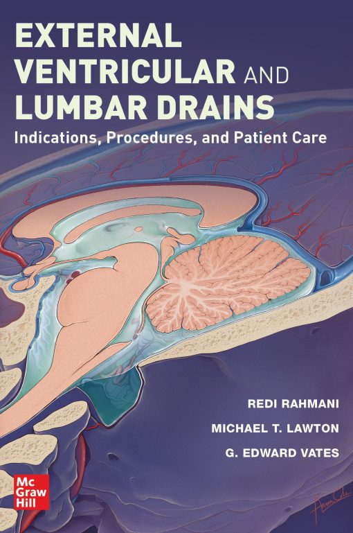 External Ventricular And Lumbar Drains: Indications, Procedures, And Patient Care (Original PDF From Publisher)