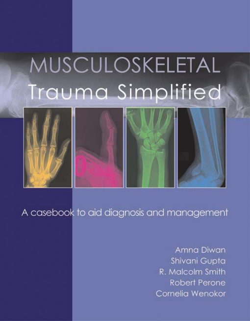 Musculoskeletal Trauma Simplified (EPUB)