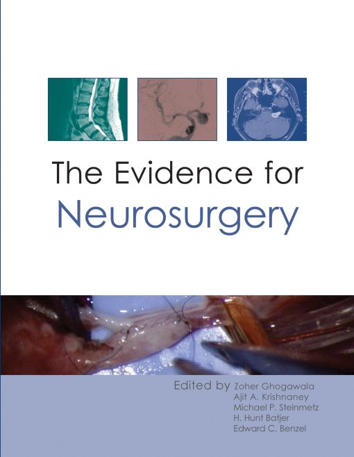 The Evidence For Neurosurgery (EPUB)