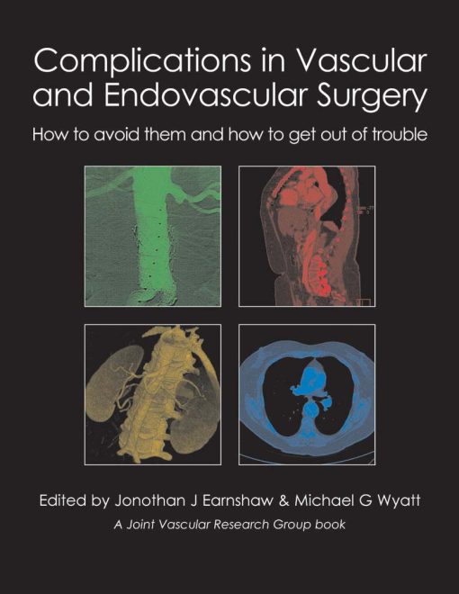 Complications In Vascular And Endovascular Surgery: How To Avoid Them And How To Get Out Of Trouble (EPUB)
