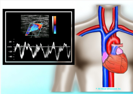Mastering Upper Extremity Duplex – AllAboutUltrasound (Complete HTML)