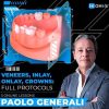 OHI S Veneers Inlay Onlay Crowns
