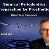 Surgical Periodontics Preparation for Prosthetics
