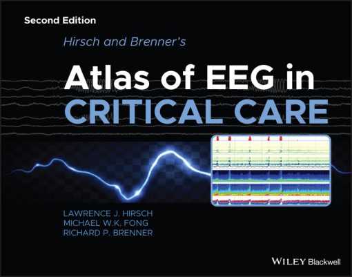 Hirsch and Brenner?s Atlas of EEG in Critical Care, 2nd Edition (EPUB)