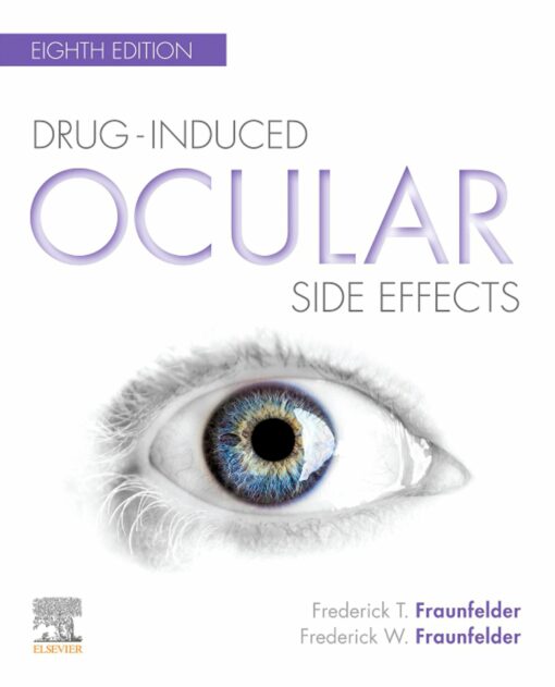 Drug-Induced Ocular Side Effects:Clinical Ocular Toxicology, 8th Edition (EPUB)