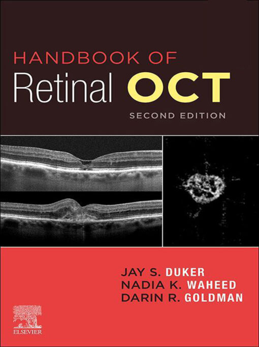 Handbook of Retinal OCT: Optical Coherence Tomography, 2nd Edition (EPUB)