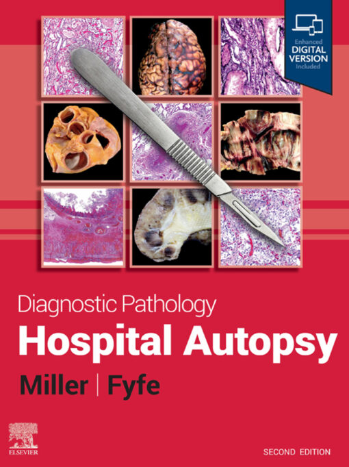 Diagnostic Pathology: Hospital Autopsy, 2nd Edition (EPUB)